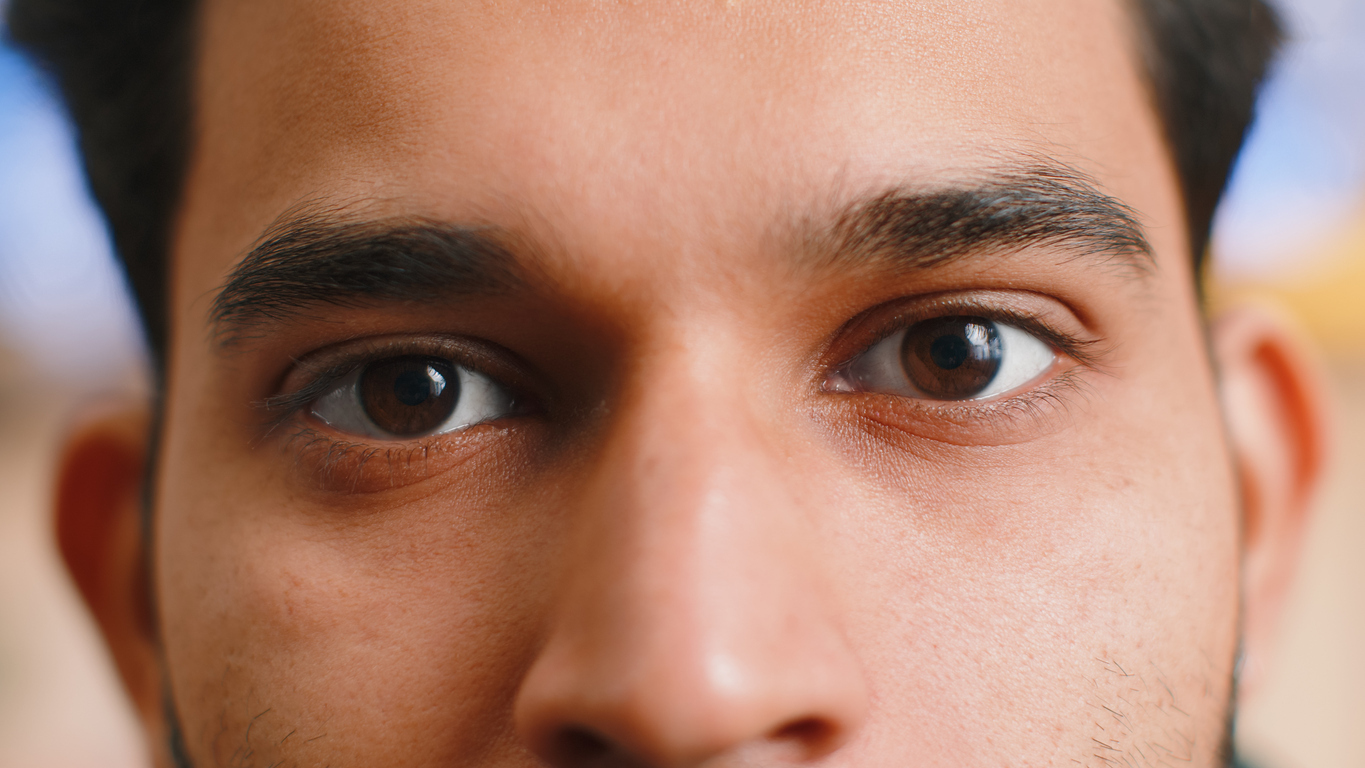 Close-up of male patient’s eyes